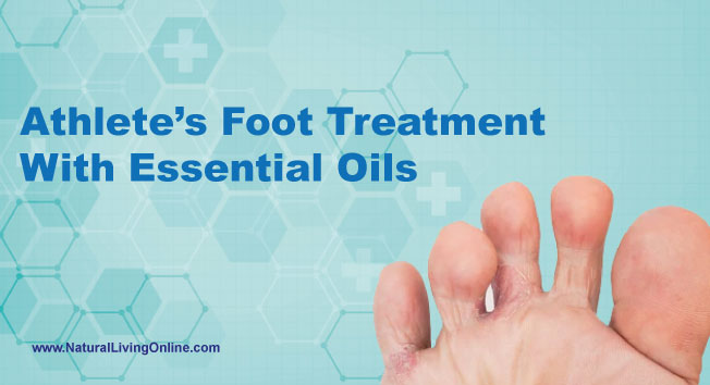 Athlete’s foot treatment with essential oils