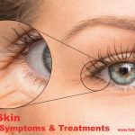 Aging Skin, Causes, Symptoms and Treatments