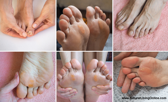 Listerine Foot Soak Benefits