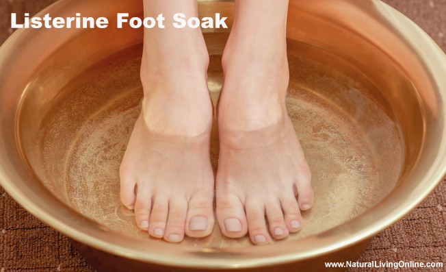 Listerine foot soak
