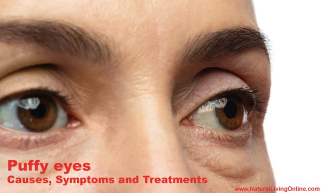 Puffy eyes Causes, Symptoms and Treatment