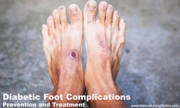 Diabetic Foot Complications, Symptoms, Prevention and Treatment