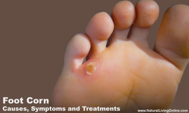 Foot Corn Causes and Treatment