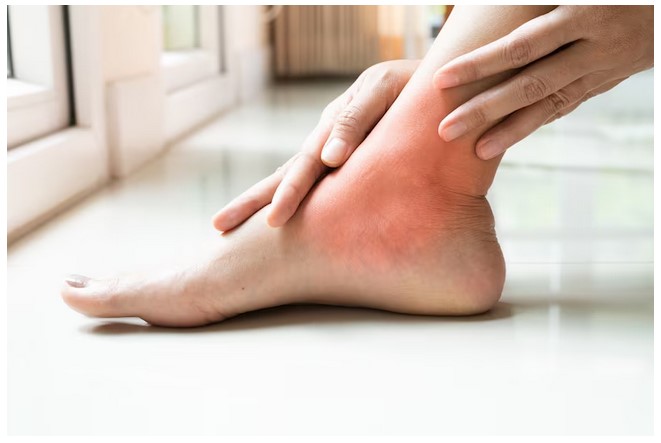Neuropathy Foot Pain